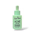 best anti acne face serum in pakistan